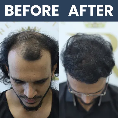 Hair Result